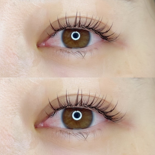 フラットラッシュ