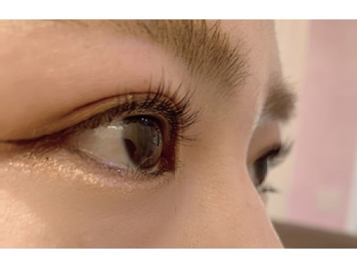 パリジェンヌラッシュとは