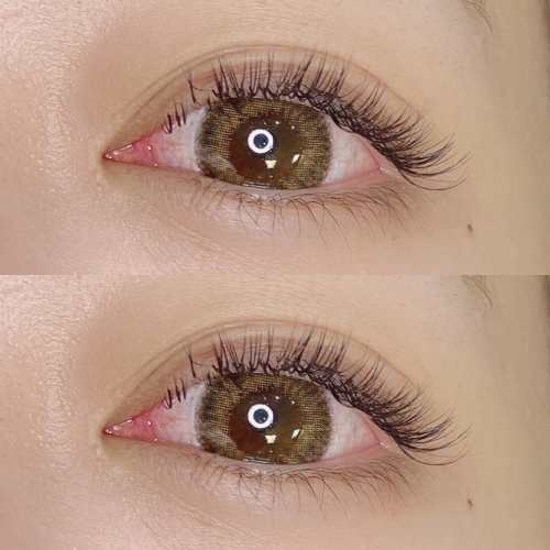 バインドロック