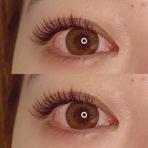 バインドロック100束