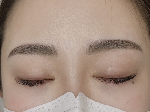 ハリウッドブロウリフト