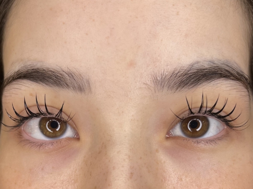 フラットラッシュ