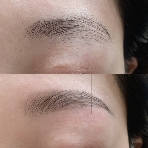 ハリウッドブロウリフト