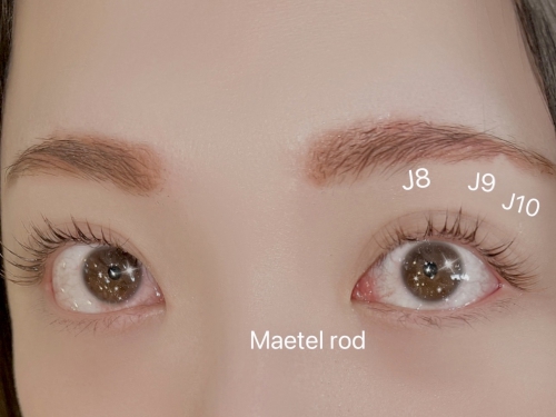 メーテルロッド×バインドロック50束