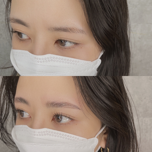 ハリウッドブロウリフト