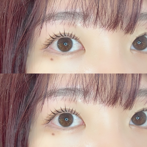 バインドロック