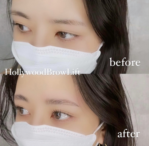 ハリウッドブロウリフト