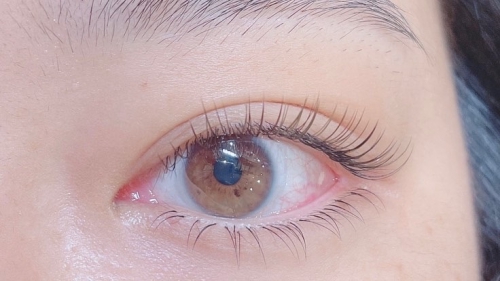 フラットラッシュ