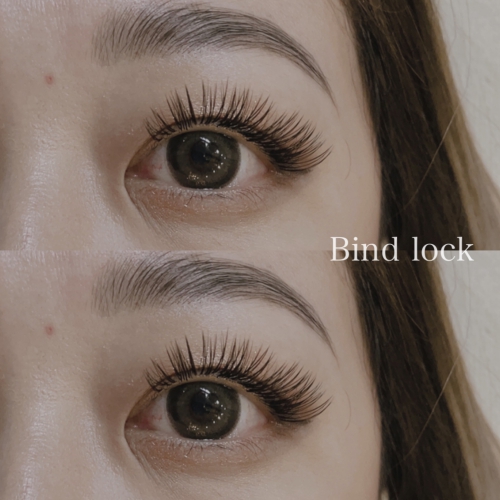 バインドロック 