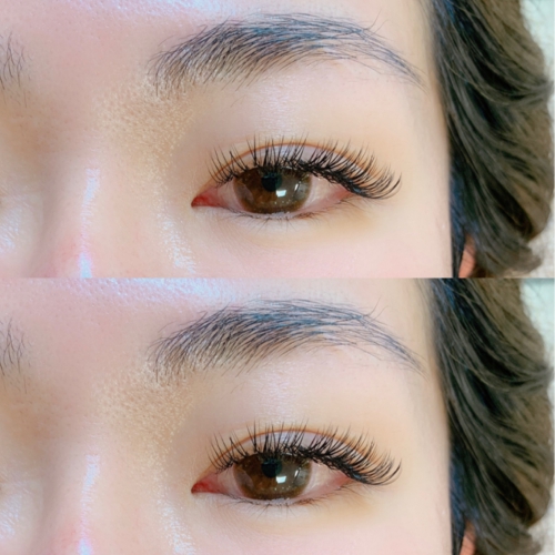 バインドロック 