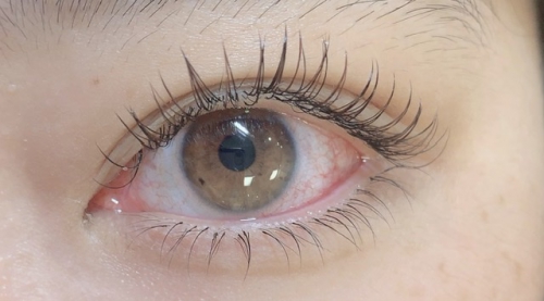 フラットラッシュ