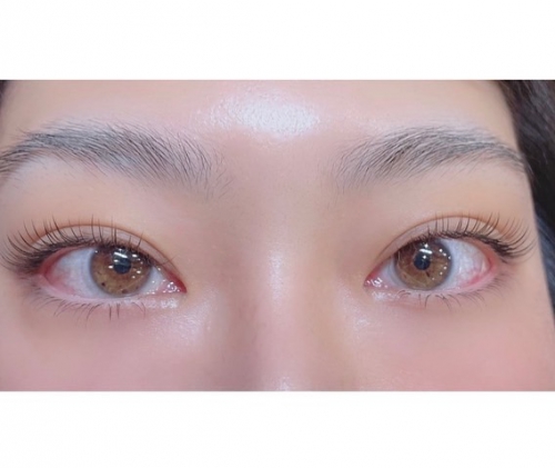 フラットラッシュ