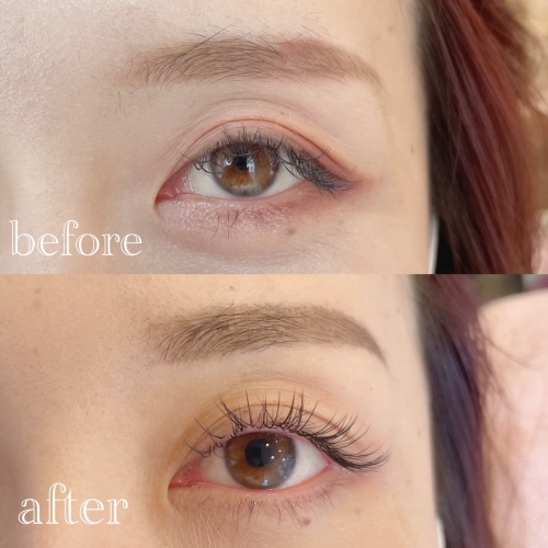 アジャストリフト