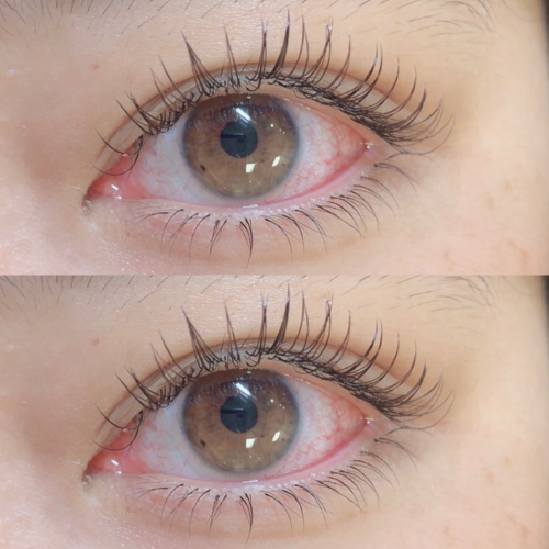 フラットラッシュ