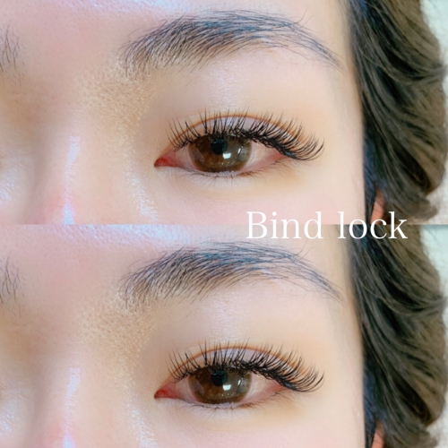 バインドロック 