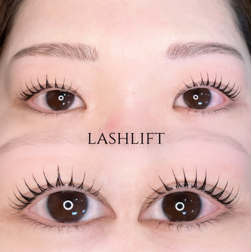 ラッシュリフト ピーナッツロッド