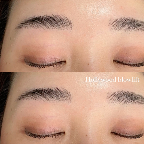 ハリウッドブロウリフト