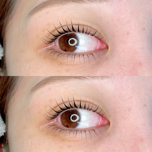 上下ラッシュリフト