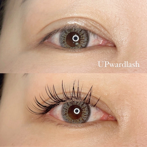 アップワードラッシュ