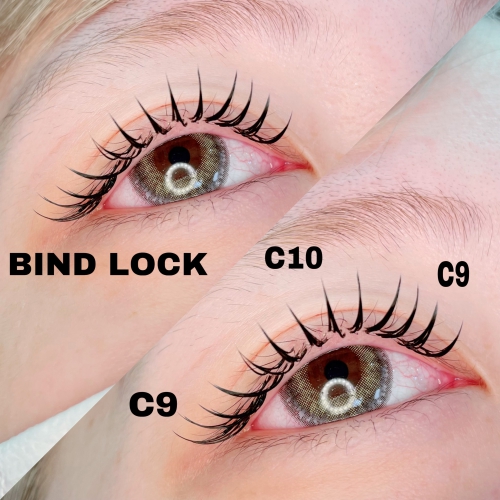 バインドロック