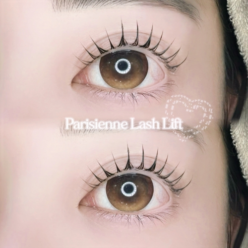 パリジェンヌリフト