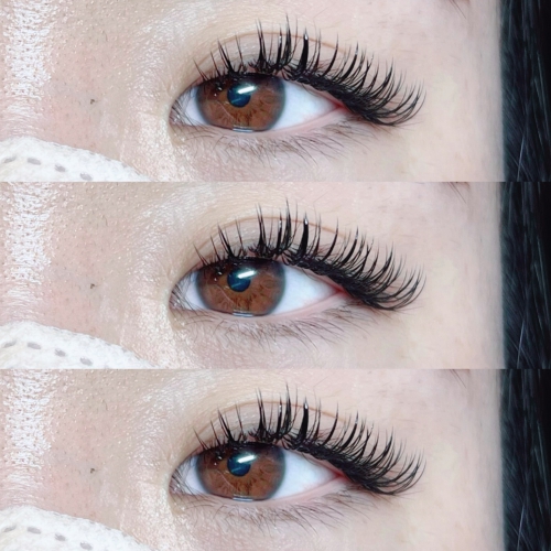 バインドロック