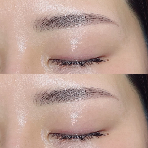 ハリウッドブロウリフト