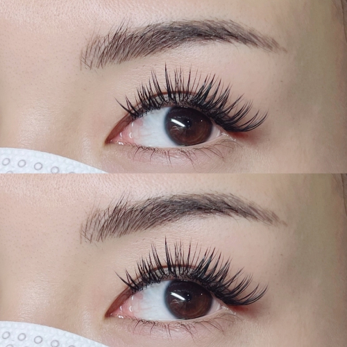 バインドロック