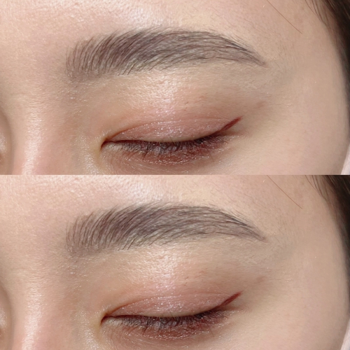 ハリウッドブロウリフト