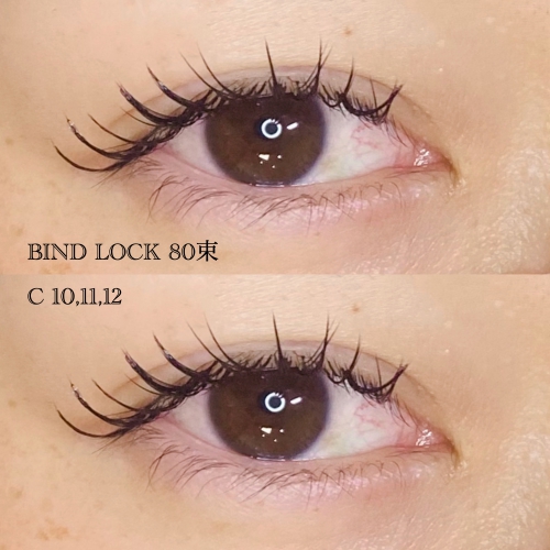 バインドロック