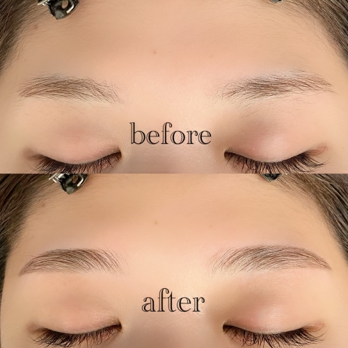 ハリウッドブロウリフト