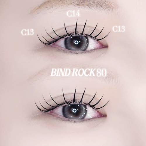 バインドロック