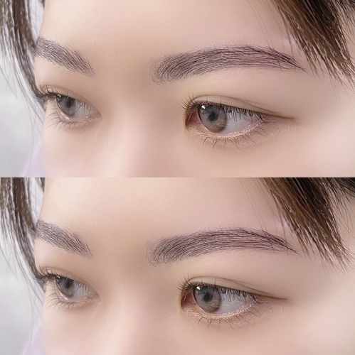 ハリウッドブロウリフト