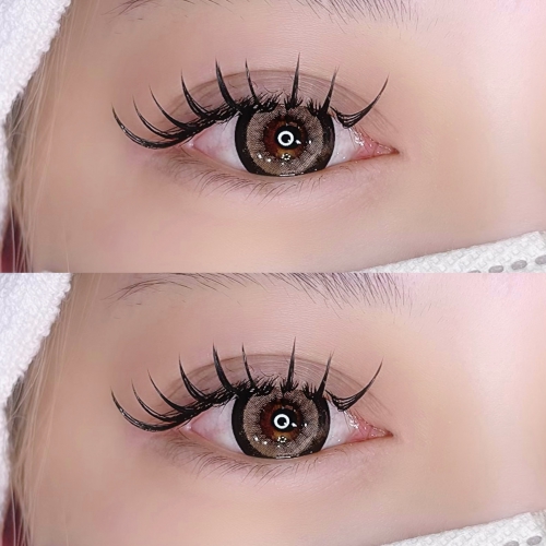 バインドロック