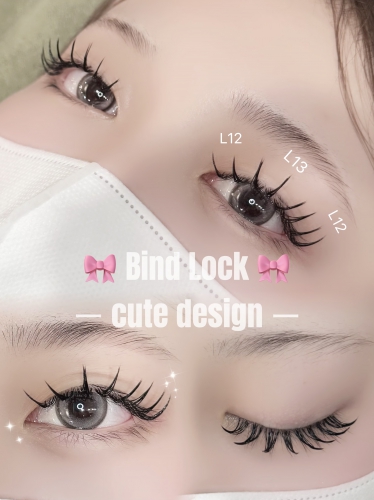 バインドロック